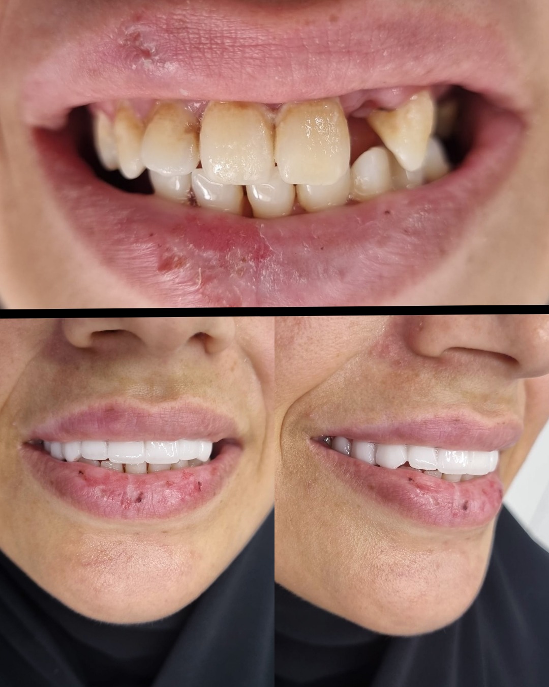 Before After 3