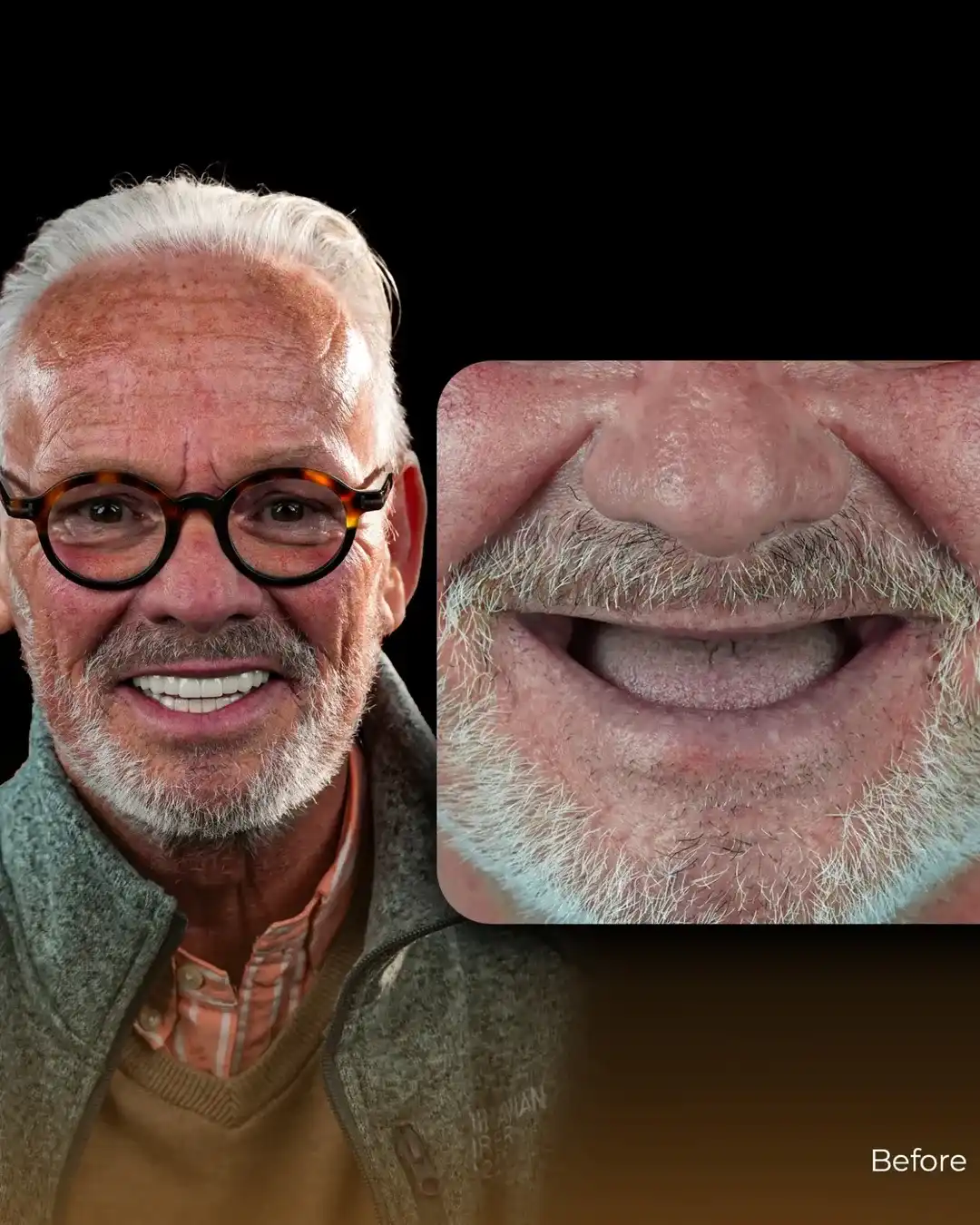 Before After 2