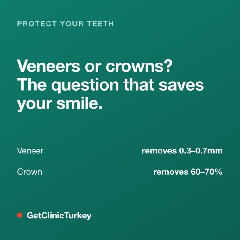 Veneers vs crowns comparison — Dental Crowns in Turkey guide