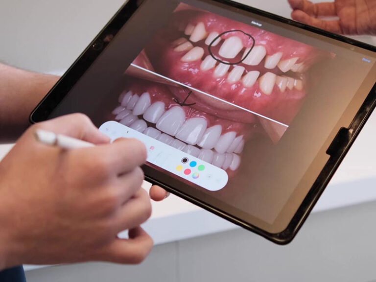Digital smile design consultation at Clinic Prime Istanbul