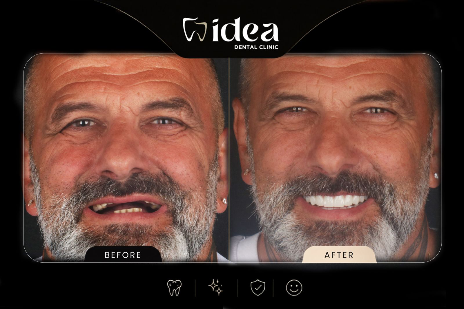 Before After 1
