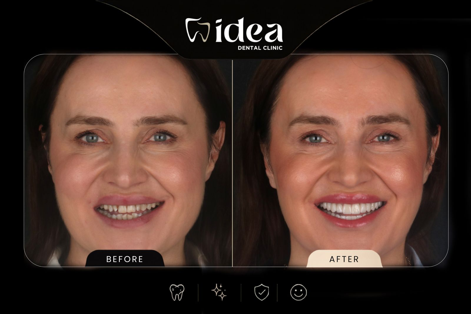 Before After 2