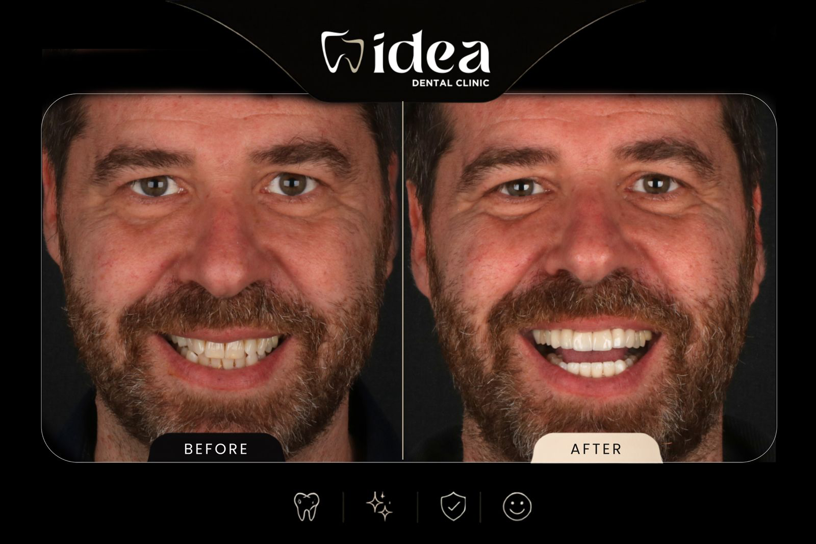 Before After 3