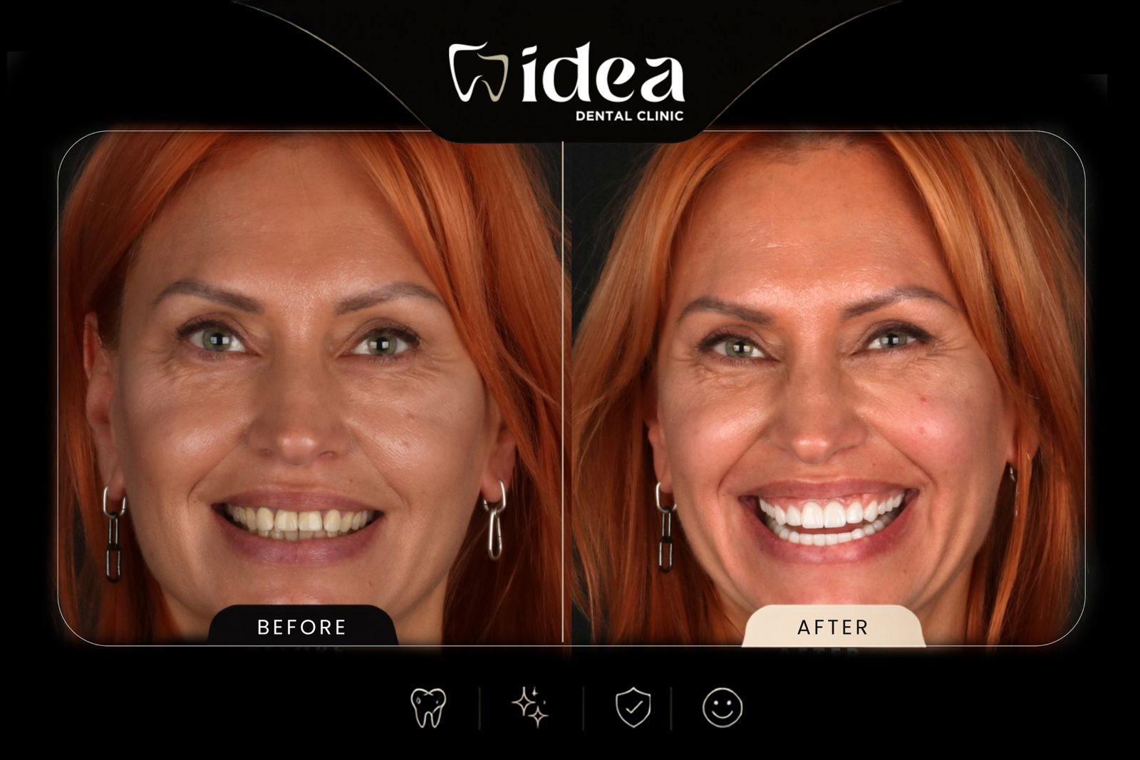 Before After 4