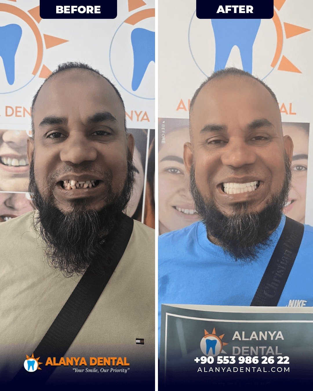 Before After 1