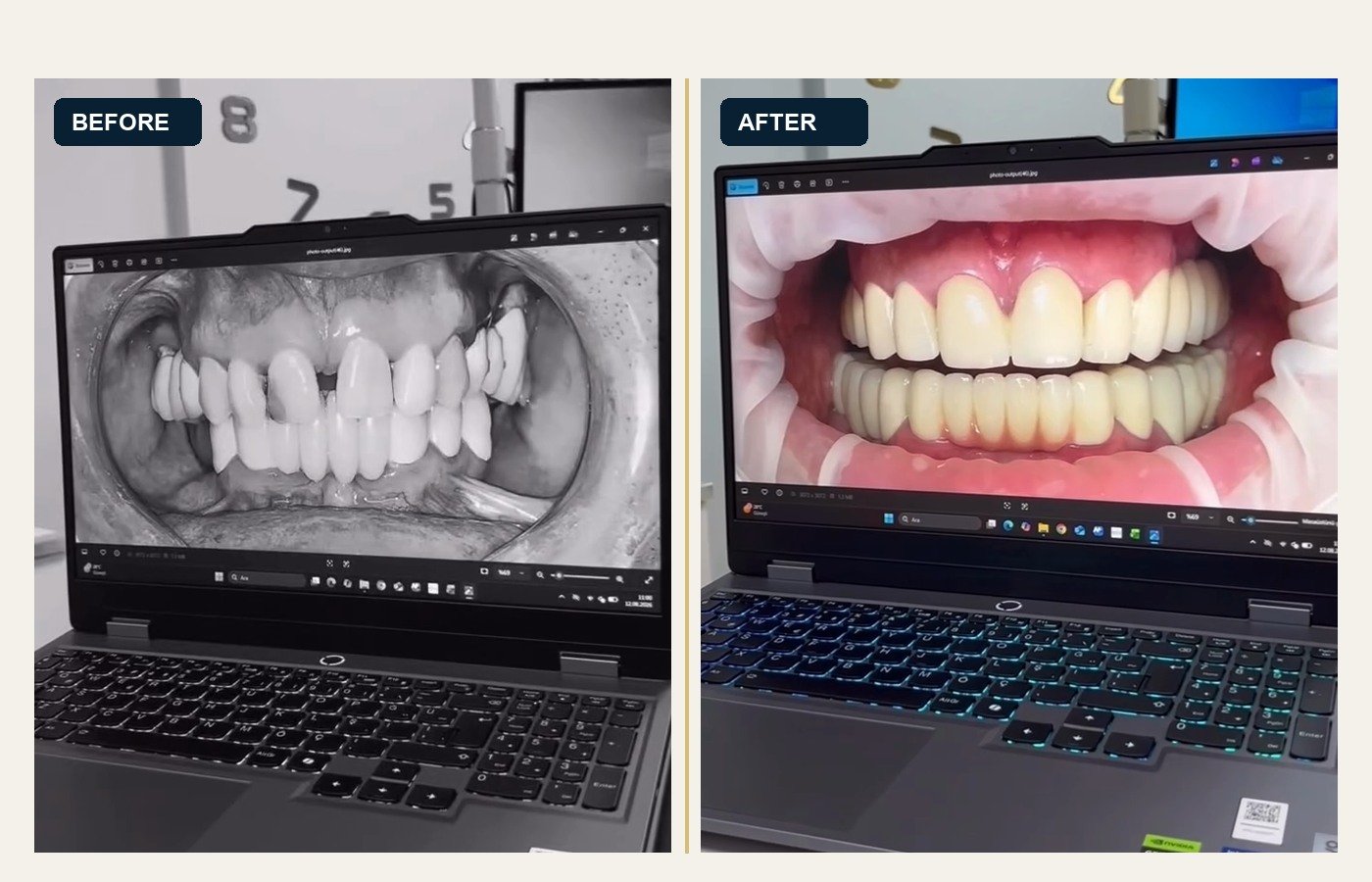 Before After 1