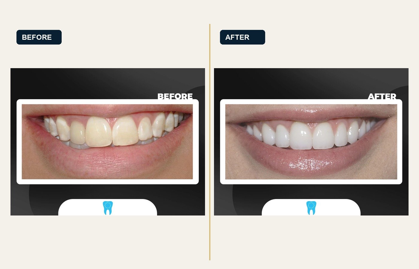 Before After 1