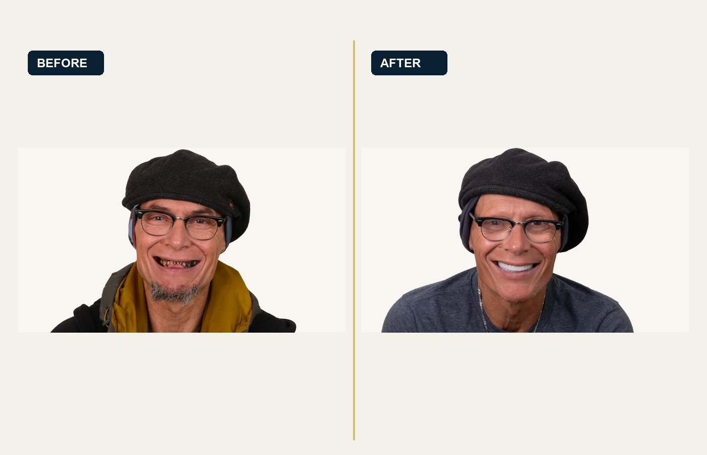 Before After 1