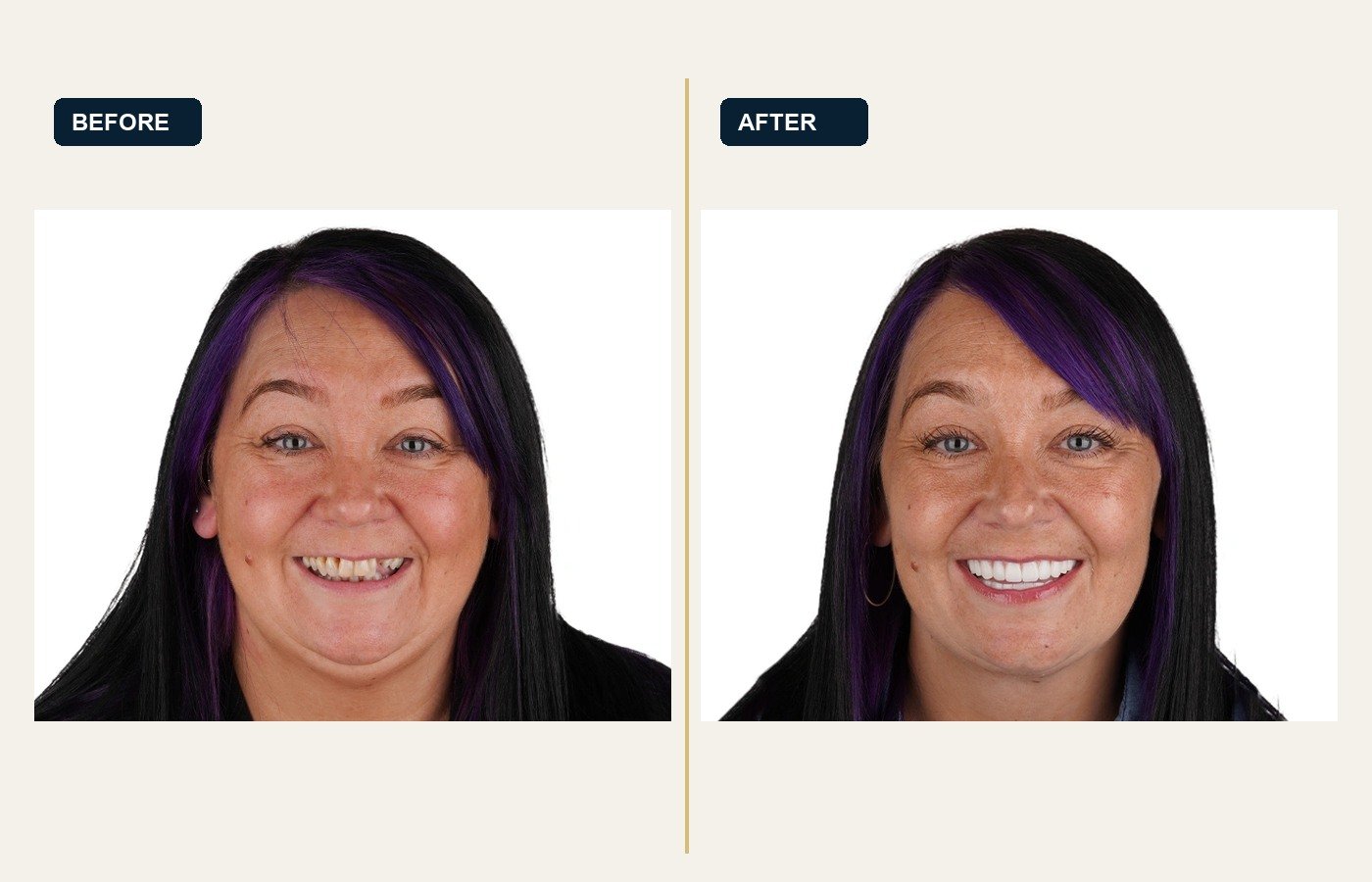 Before After 1