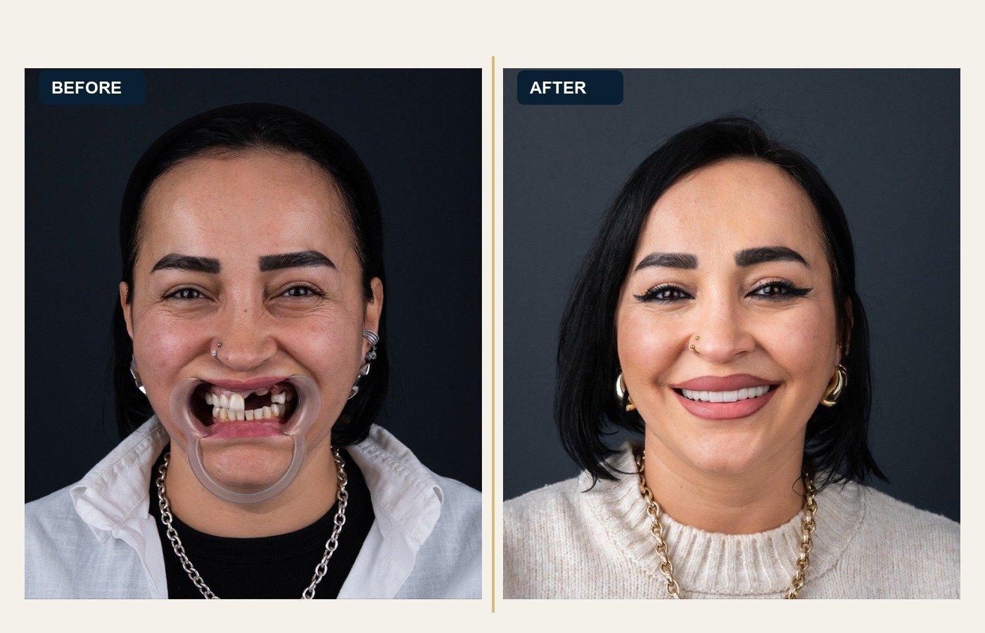 Before After 1