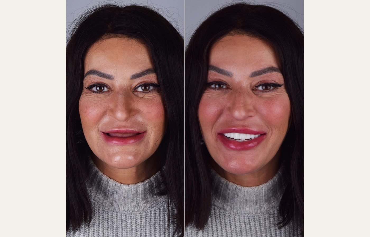 Before After 1