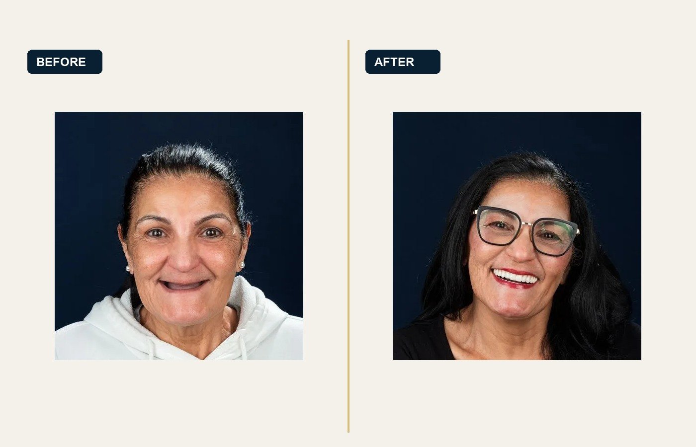 Before After 1