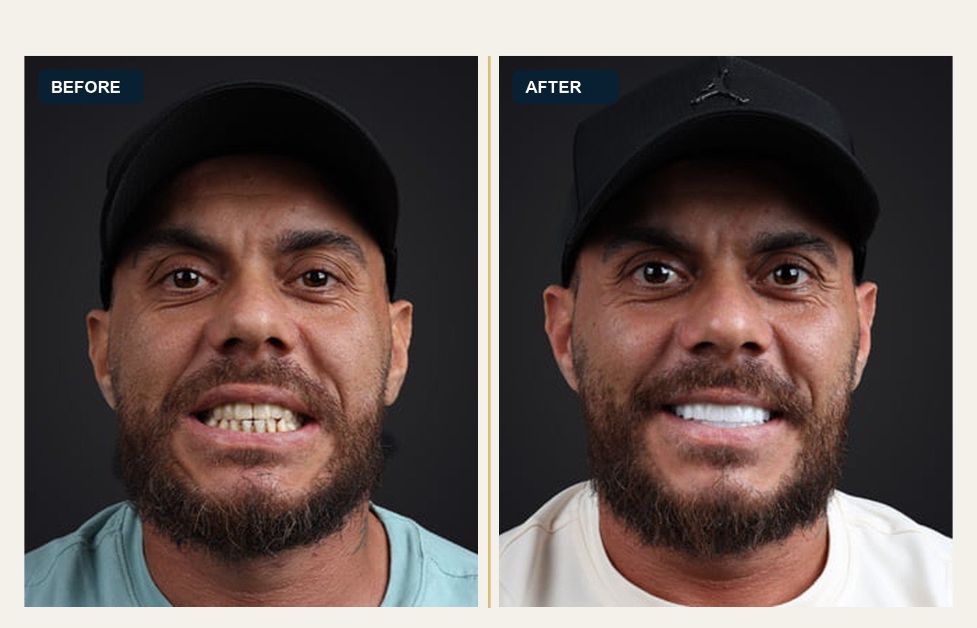 Before After 1