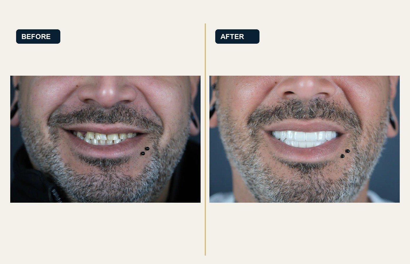 Before After 1