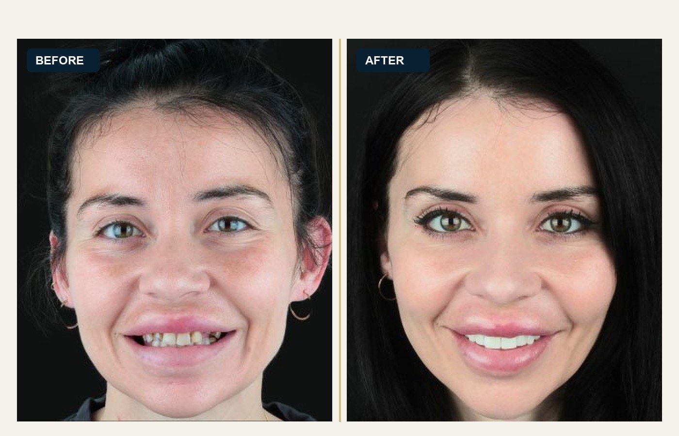 Before After 1