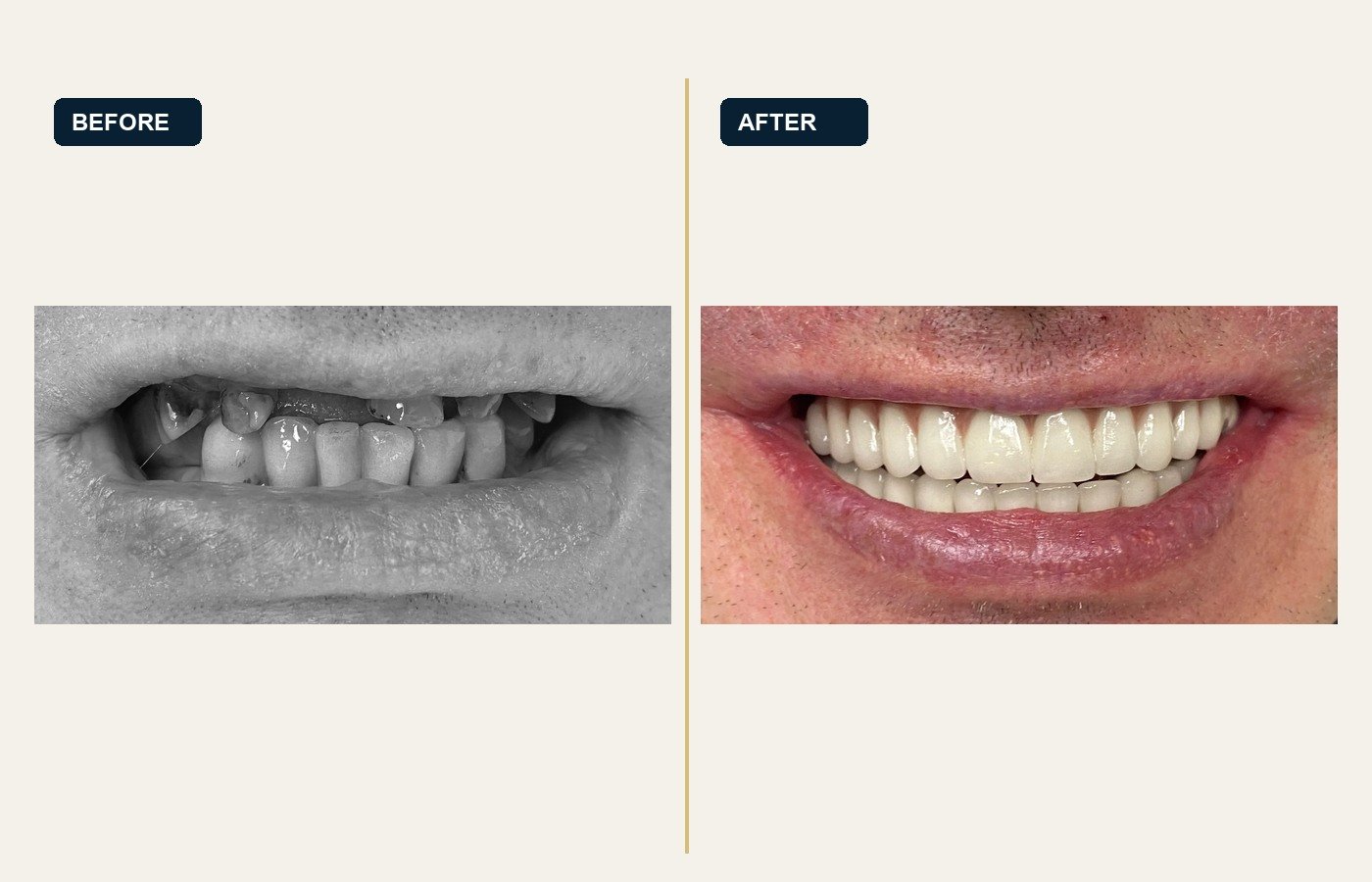 Before After 1