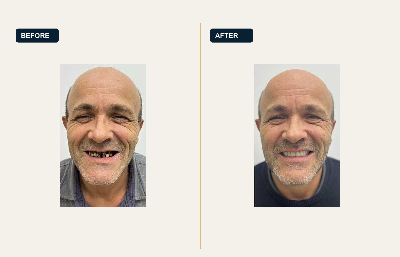 Before After 1