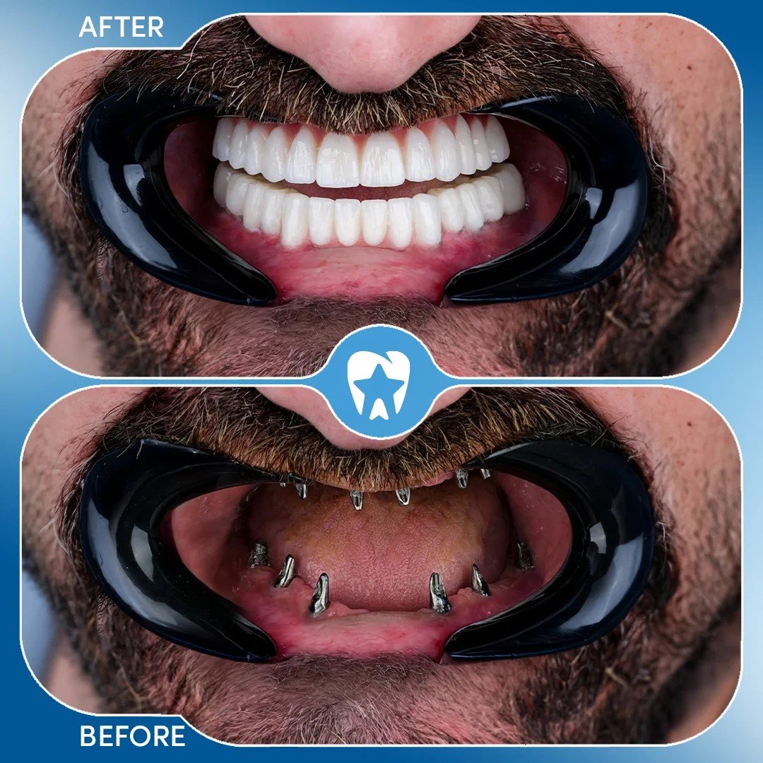 Before After 1