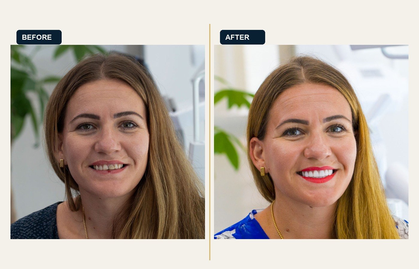 Before After 1
