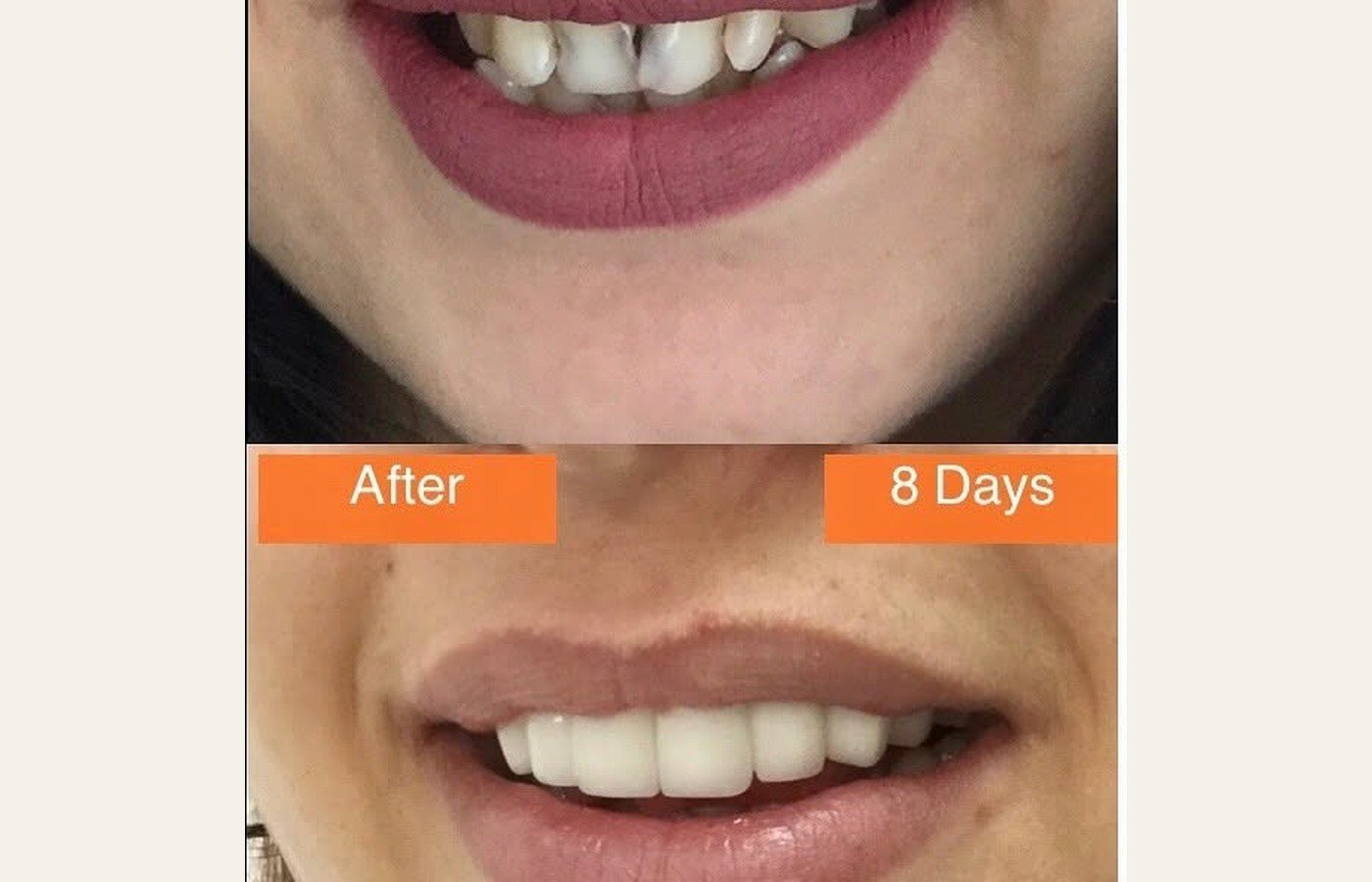 Before After 1