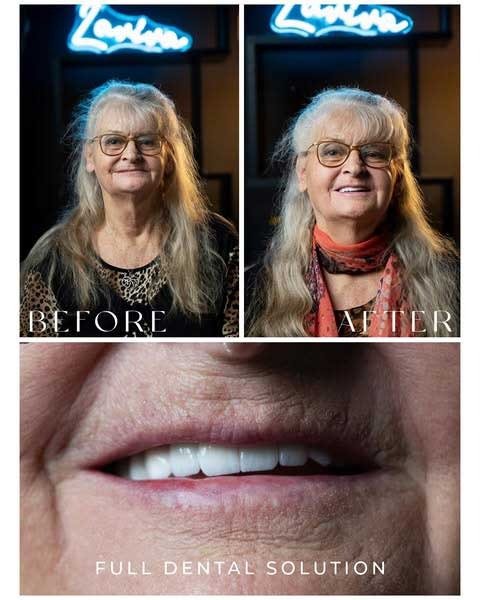 Before After 1