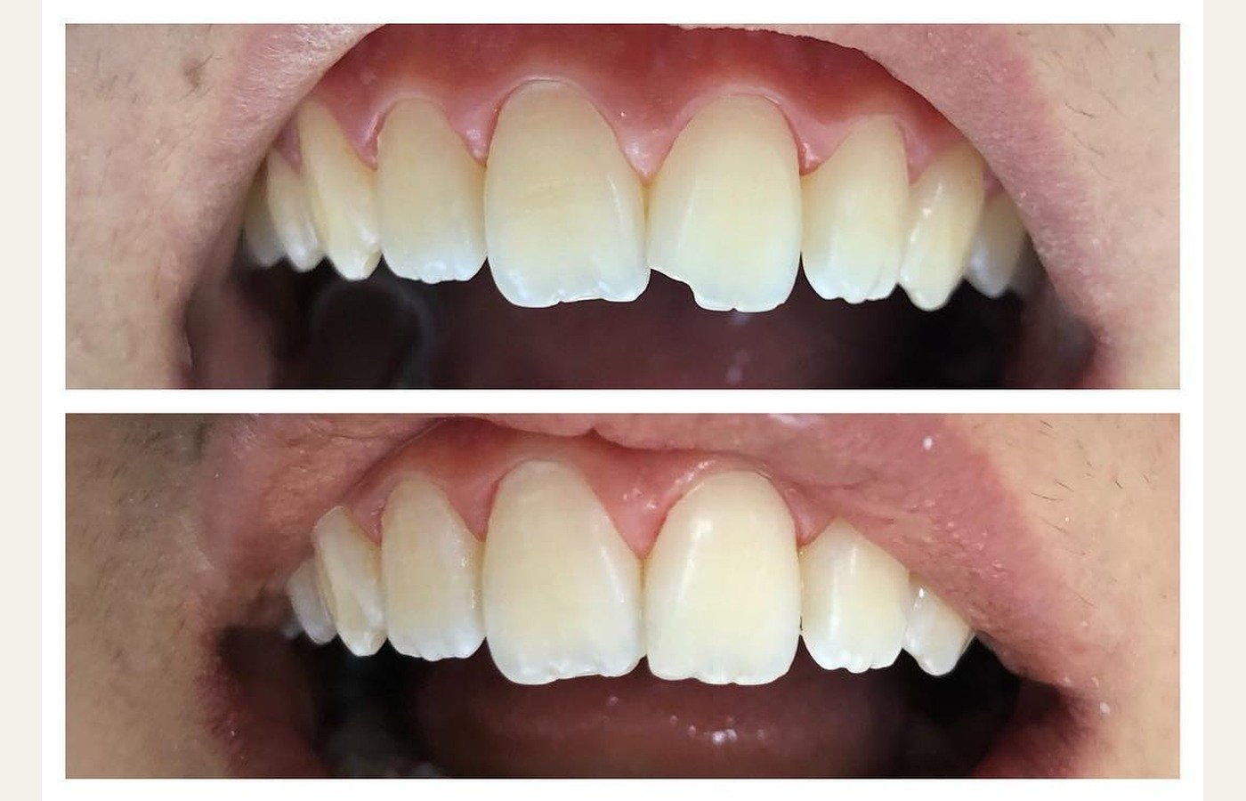 Before After 1