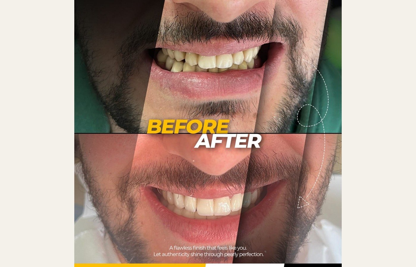 Before After 1