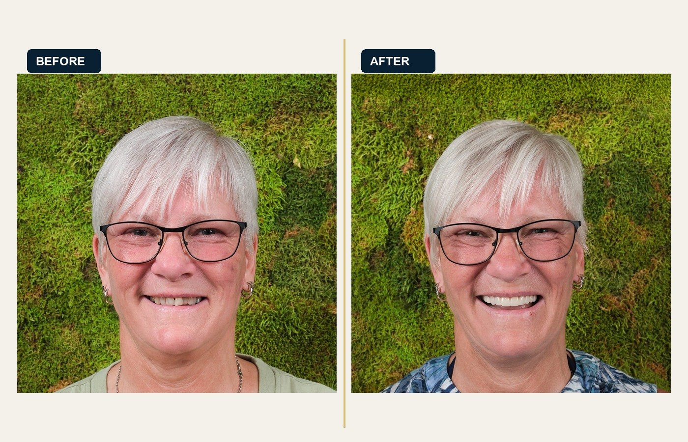 Before After 1
