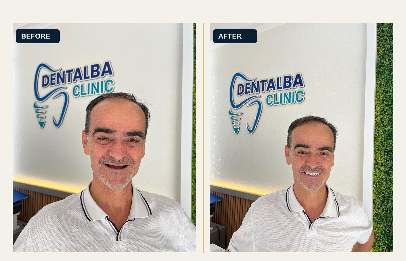 Before After 1
