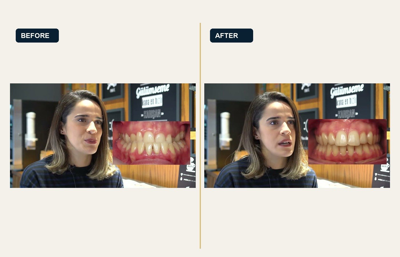 Before After 1