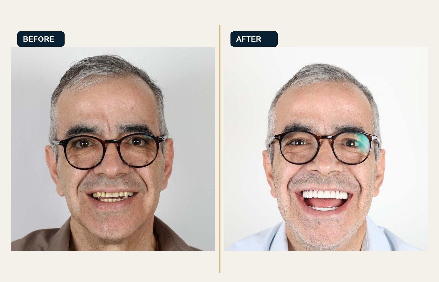 Before After 1