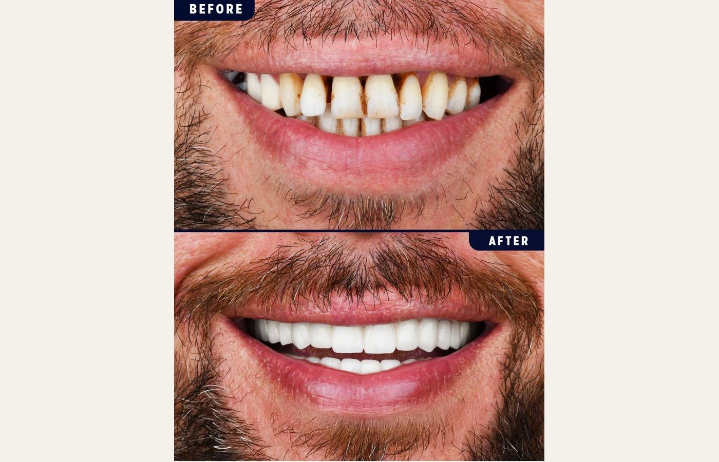 Before After 1