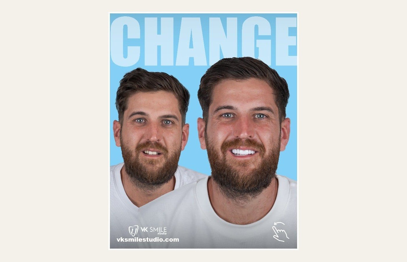 Before After 1