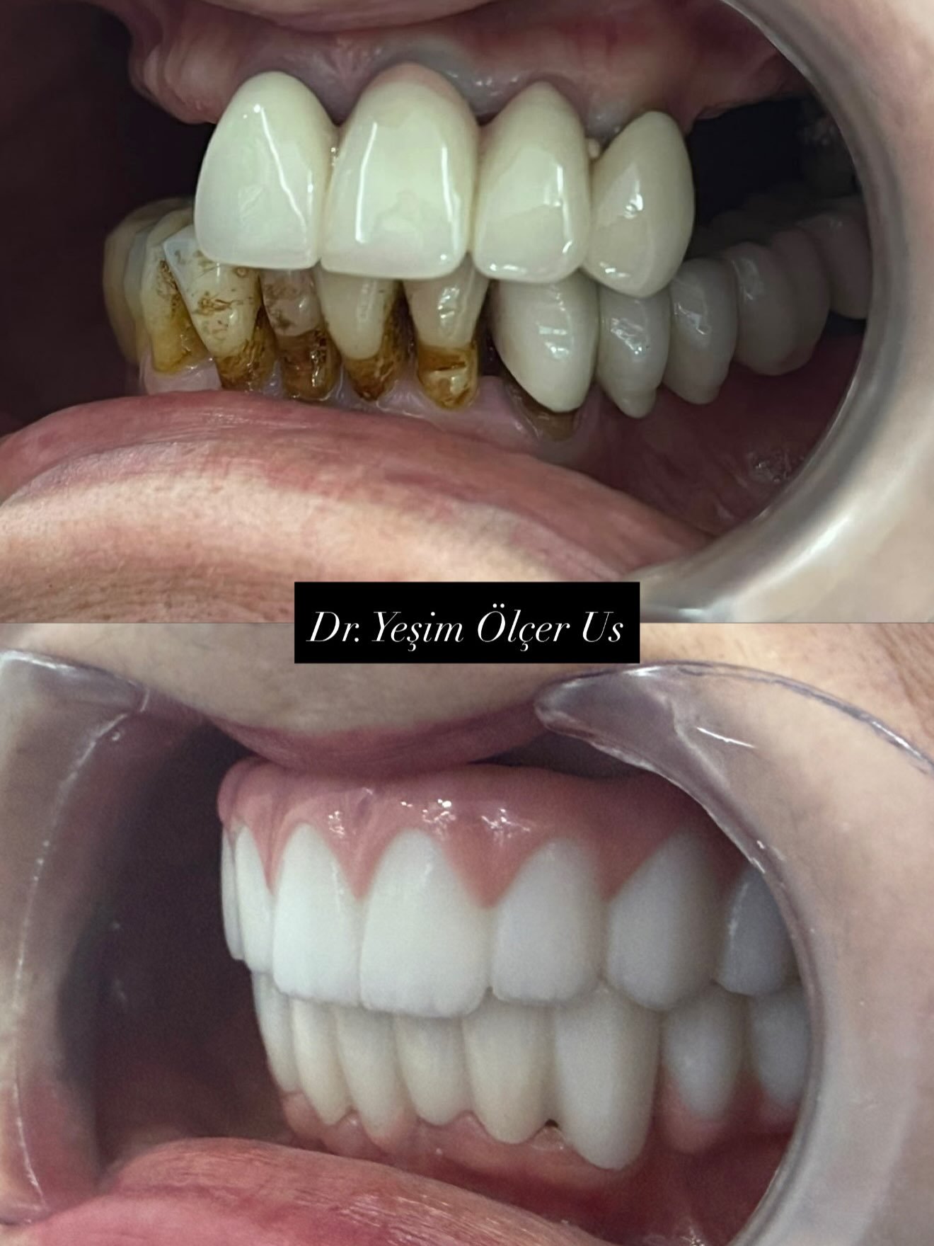 Before After 3
